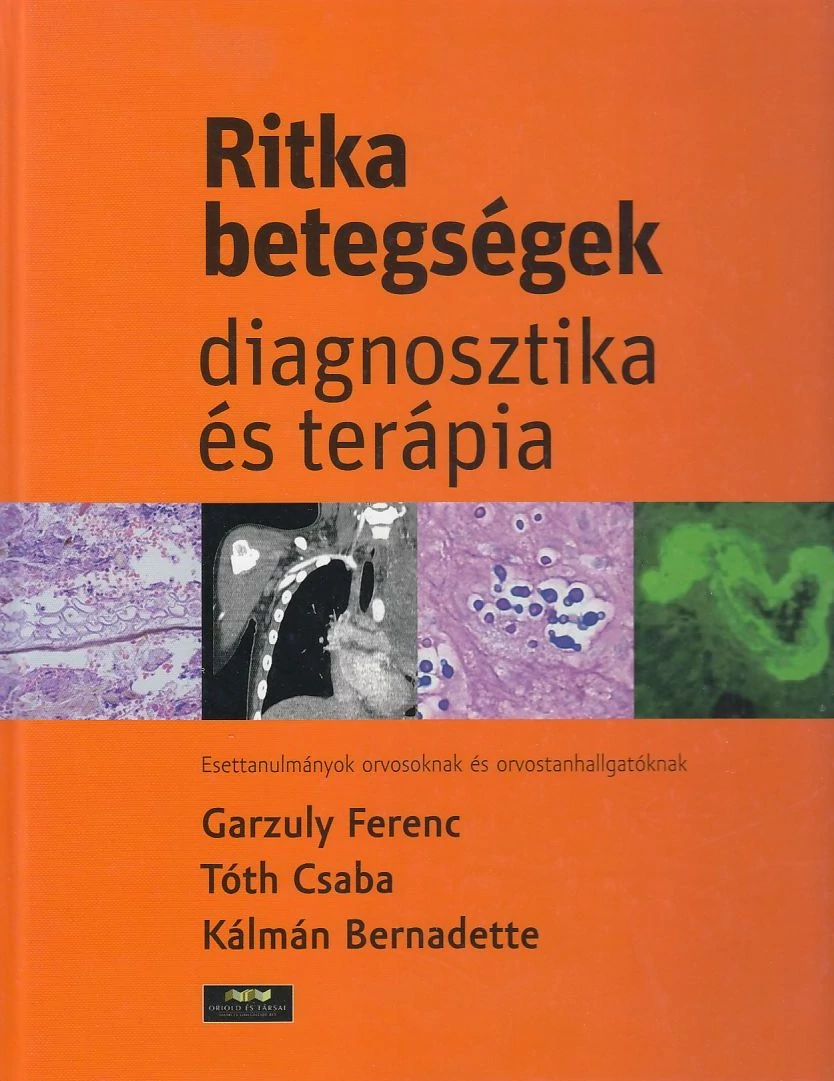 Ritka betegségek – diagnosztika és terápia